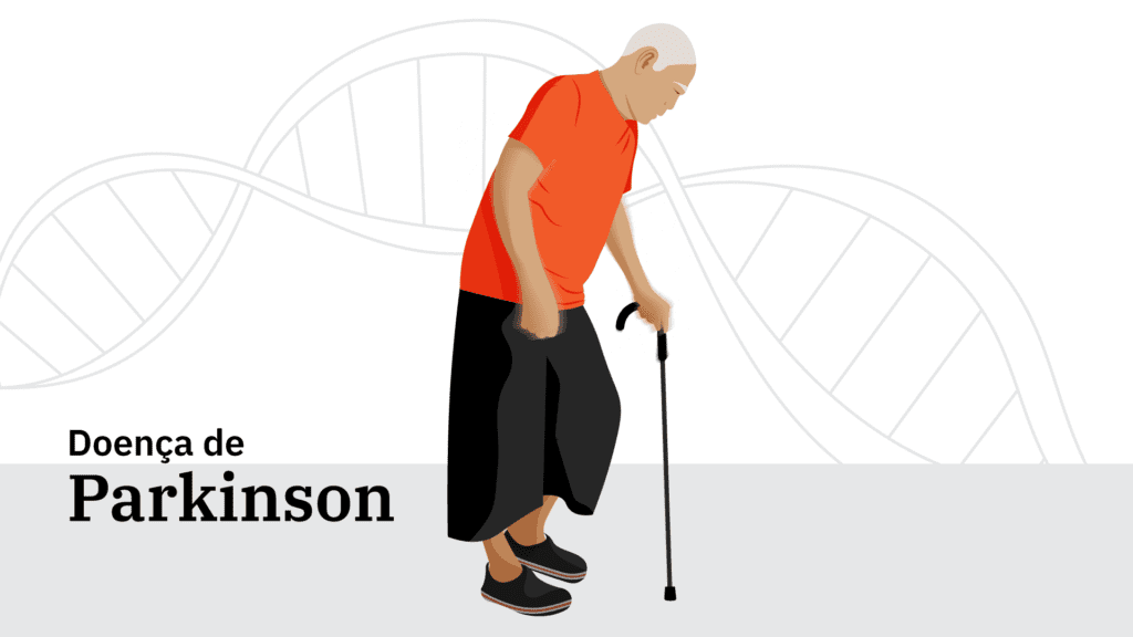 Pessoa com sintomas da Doença de Parkinson, incluindo tremores e rigidez muscular