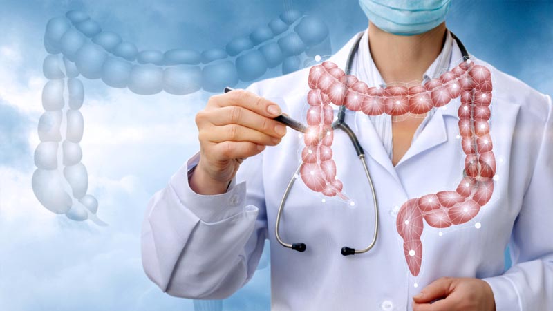Câncer de intestino - Gráfico de fatores de risco e sintomas