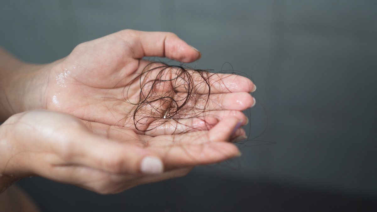 Ilustração dos tipos e causas da queda de cabelo